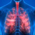 Epilepsia: cómo reconocer una crisis y por qué actuar a tiempo puede cambiar una vida