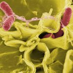Infecciones respiratorias, gastrointestinales y urinarias  concentran las atenciones médicas en México